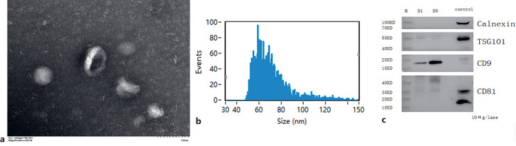 Different Expression Profiles of Exosomal circRNAs from Apheresis Platelets during Storage.