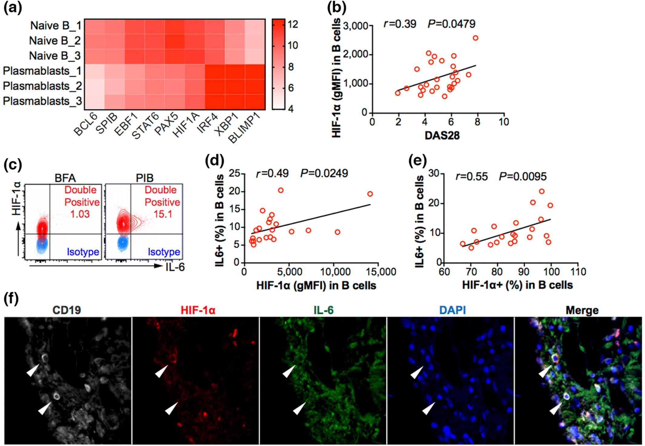 Hypoxia-inducible factor-1α regulates the interleukin-6 production by B cells in rheumatoid arthritis