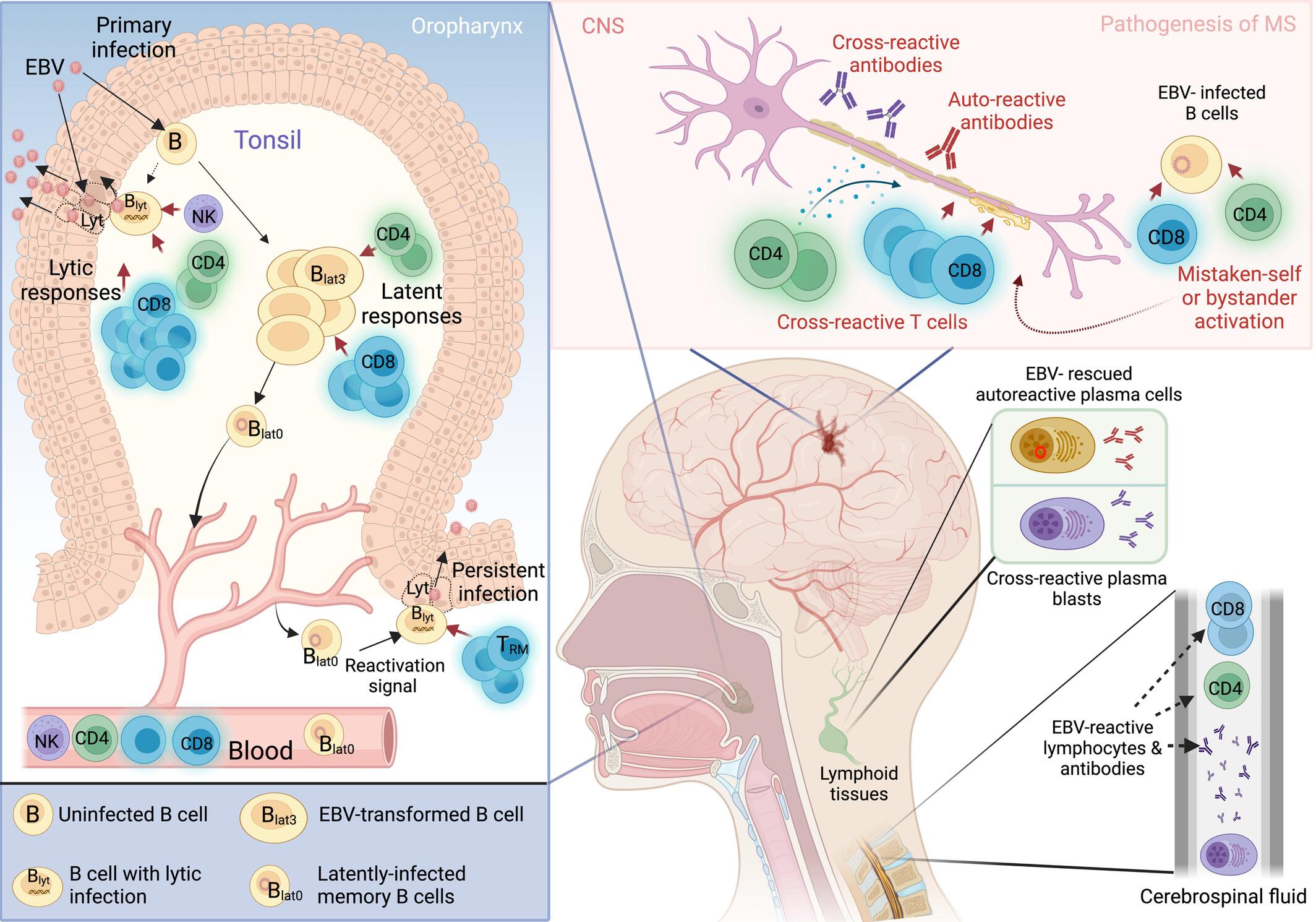 Epstein–Barr virus and multiple sclerosis: moving from questions of association to questions of mechanism