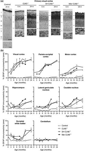 Characterization of neuropathology in ovine CLN5 and CLN6 neuronal ceroid lipofuscinoses (Batten disease)