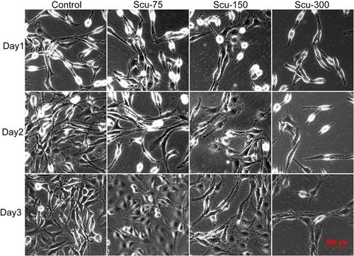 Scutellarein treats neuroblastoma by regulating the expression of multiple targets