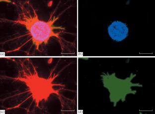 Interaction of Mesenchymal Stromal Cells with 5XFAD Mouse Hippocampal Cells in Primary Culture Depending on Cocultivation Method