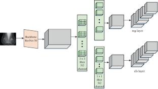 Detection and Prediction of Breast Cancer Using Improved Faster Regional Convolutional Neural Network Based on Multilayer Perceptron’s Network