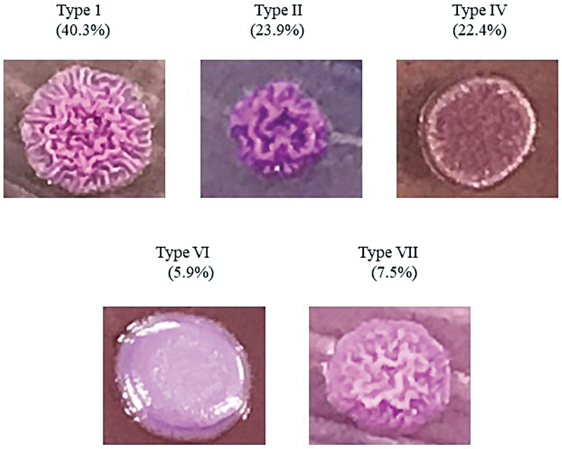 Variable Virulence Genes in Clinical Isolates of <i>Burkholderia pseudomallei</i> : Impact on Disease Severity and Outcome in Melioidosis.