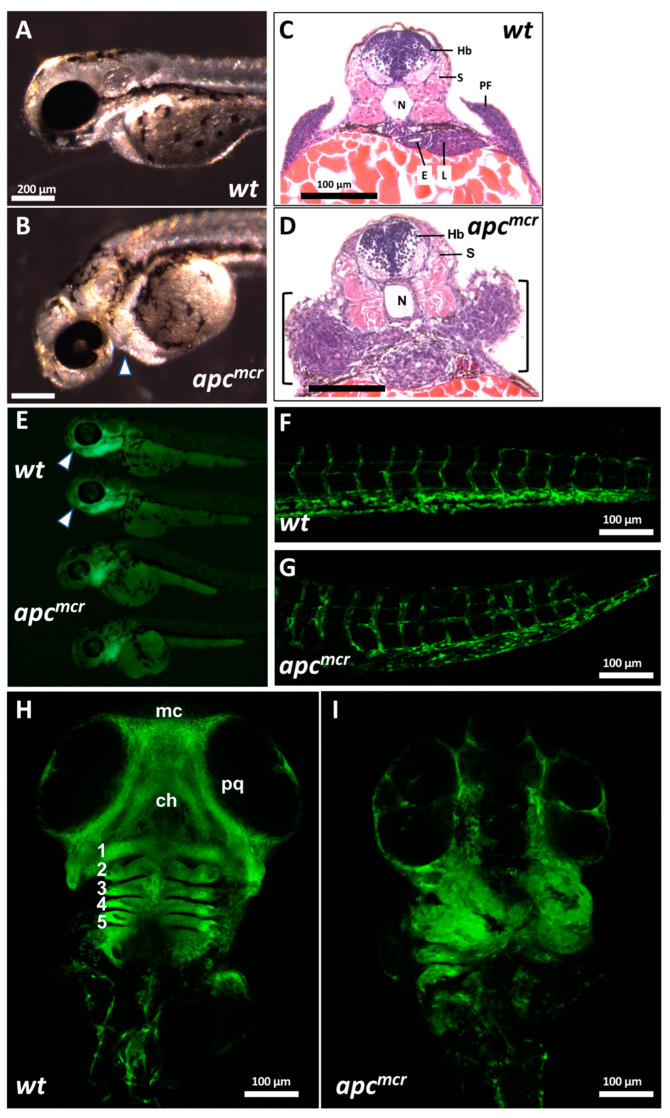 The Tumor Suppressor <i>Adenomatous Polyposis Coli (apc)</i> Is Required for Neural Crest-Dependent Craniofacial Development in Zebrafish.