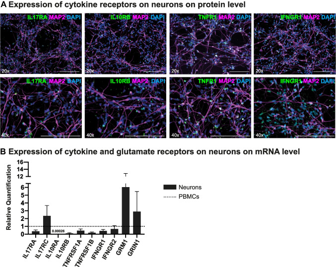 Inflammatory Cytokines Associated with Multiple Sclerosis Directly Induce Alterations of Neuronal Cytoarchitecture in Human Neurons.