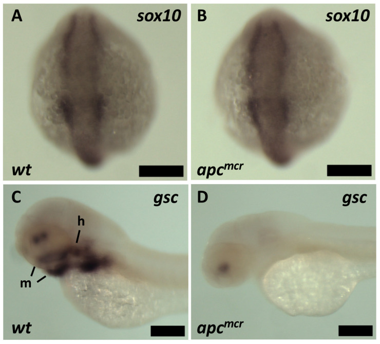 The Tumor Suppressor <i>Adenomatous Polyposis Coli (apc)</i> Is Required for Neural Crest-Dependent Craniofacial Development in Zebrafish.