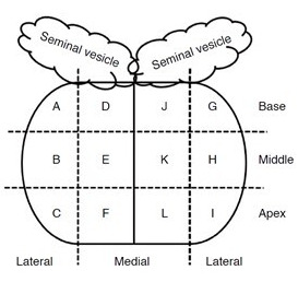 Quantification of Multi-Parametric Magnetic Resonance Imaging Based on Radiomics Analysis for Differentiation of Benign and Malignant Lesions of Prostate.