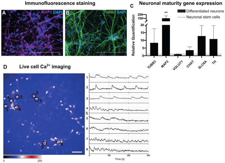 Inflammatory Cytokines Associated with Multiple Sclerosis Directly Induce Alterations of Neuronal Cytoarchitecture in Human Neurons.