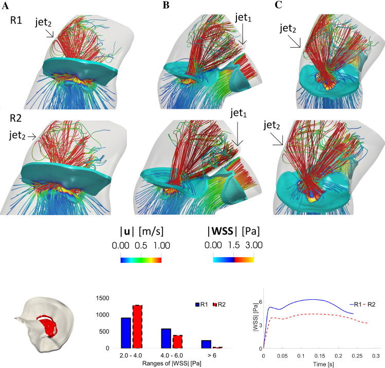 An Image-Based Computational Fluid Dynamics Study of Mitral Regurgitation in Presence of Prolapse.