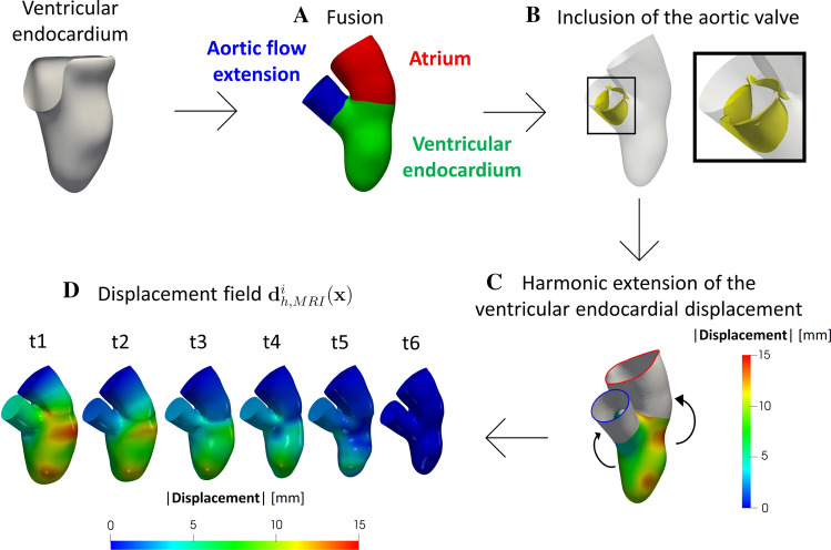 An Image-Based Computational Fluid Dynamics Study of Mitral Regurgitation in Presence of Prolapse.