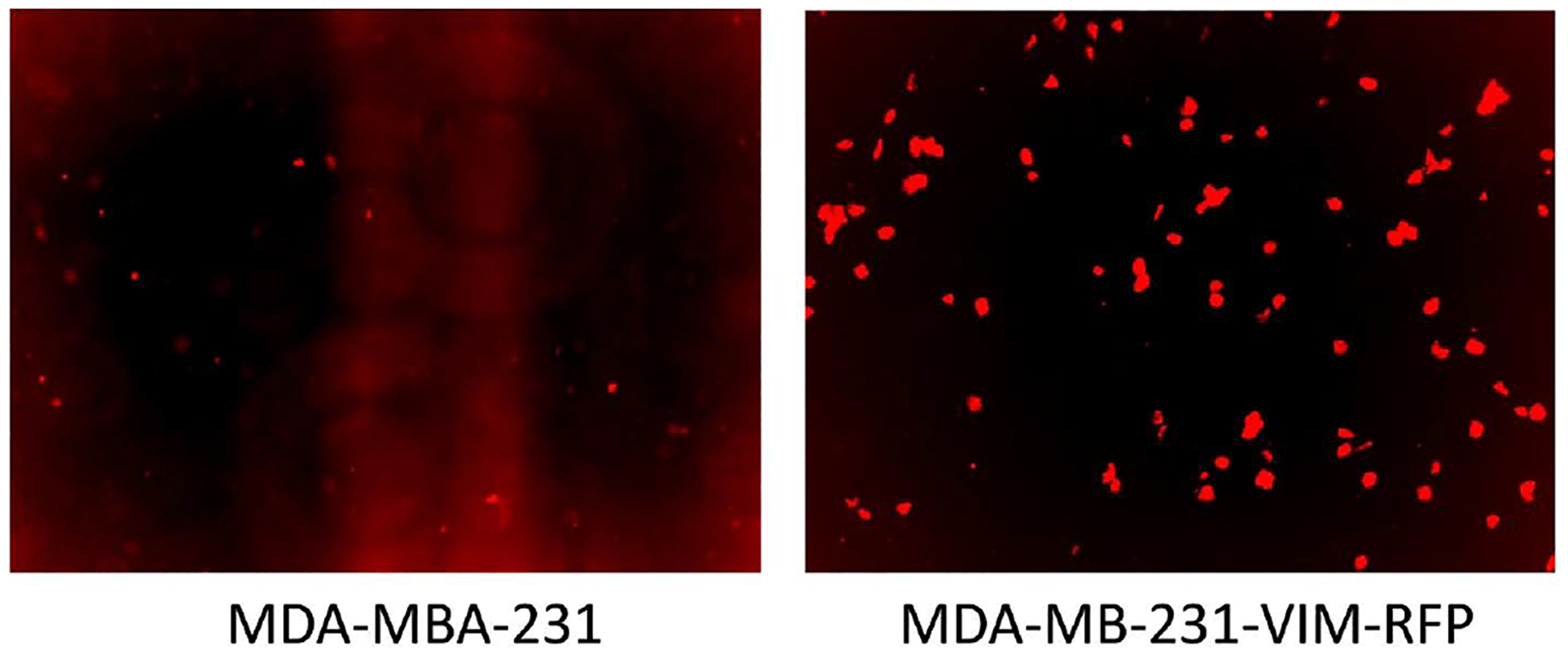 Analysis of Differential Gene Expression and Core Canonical Pathways Involved in the Epithelial to Mesenchymal Transition of Triple Negative Breast Cancer Cells by Ingenuity Pathway Analysis.