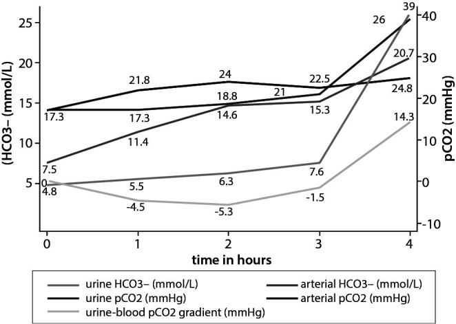 Distal renal tubular acidosis in a patient with Hashimoto's thyroiditis: a case report.