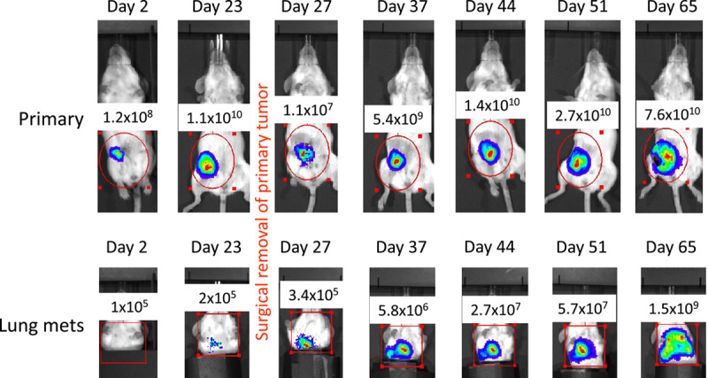 TLR Agonist Therapy of Metastatic Breast Cancer in Mice.