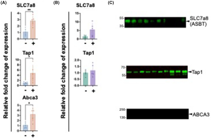 The influence of SARS-CoV-2 infection on expression of drug-metabolizing enzymes and transporters in a hACE2 murine model.