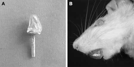 The Condylar Effects of Mesenchymal Stem Cells, Low-Level Laser Therapy and Grape Seed Extract on Functional Mandibular Advancement of the Rat Mandible.