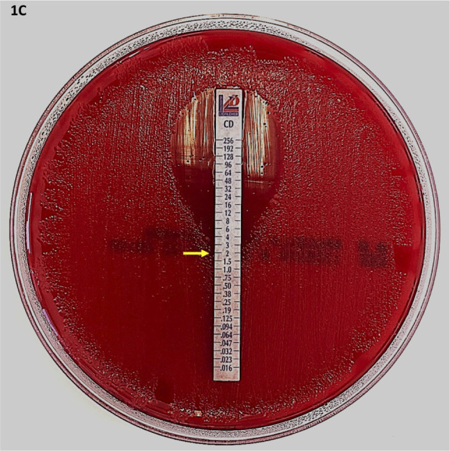 [Clostridium perfringens abscess in parenteral drug users].