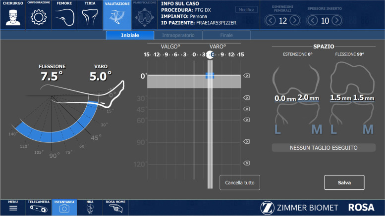 Biomechanical considerations for an easily-restricted robot-assisted kinematic alignment: a surgical technique note.