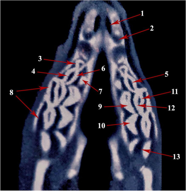 Morphological and radiological mapping of dental cusps in relation to spatial constraints on tooth shape of one humped camel (Camelus dromedarius).