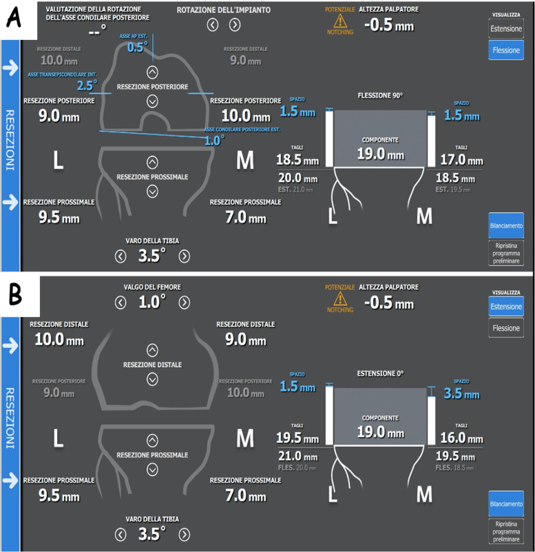 Biomechanical considerations for an easily-restricted robot-assisted kinematic alignment: a surgical technique note.