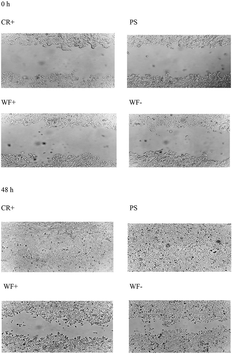 High-dose Irradiation Stimulated Breast Tumor Microenvironment to Enhance Tumor Cell Growth and Decrease Tumor Cell Motility.