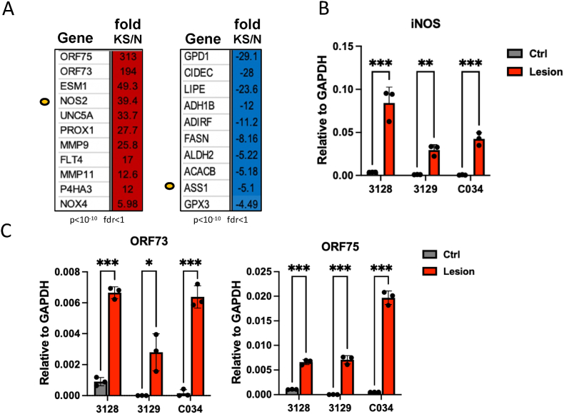 Elevated iNOS and 3′-nitrotyrosine in Kaposi's Sarcoma tumors and mouse model