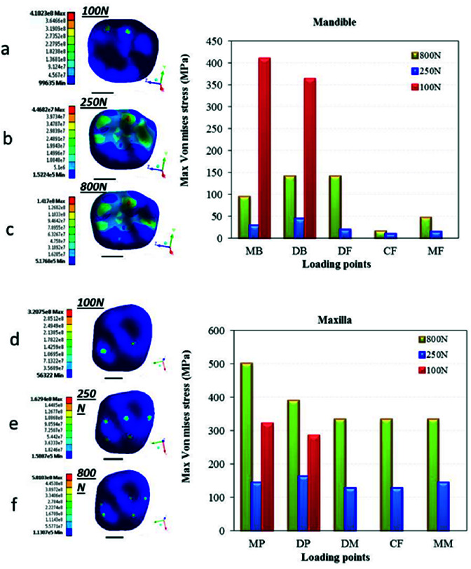 How Does the First Molar Root Location Affect the Critical Stress Pattern in the Periodontium? A Finite Element Analysis.