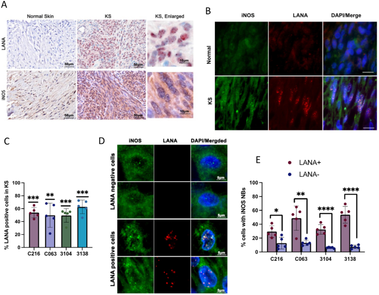 Elevated iNOS and 3′-nitrotyrosine in Kaposi's Sarcoma tumors and mouse model