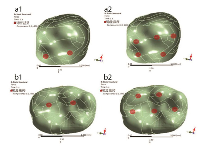 How Does the First Molar Root Location Affect the Critical Stress Pattern in the Periodontium? A Finite Element Analysis.