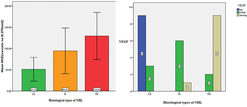 Histopathological Evaluation of Angiogenic Markers in Non-Hodgkin's Lymphoma.