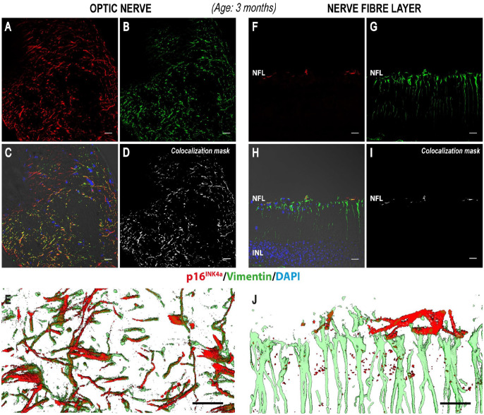 Developmental Expression of the Cell Cycle Regulator p16<sup>INK4a</sup> in Retinal Glial Cells: A Novel Marker for Immature Ocular Astrocytes?