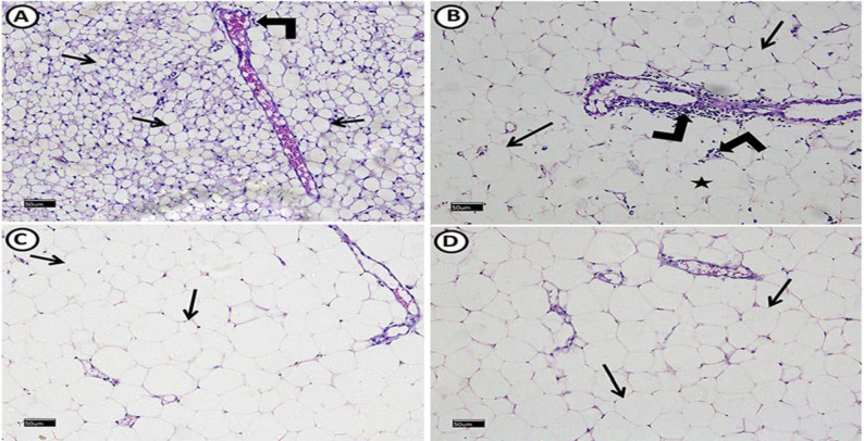 Resveratrol and Dulaglutide ameliorate adiposity and liver dysfunction in rats with diet-induced metabolic syndrome: Role of SIRT-1 / adipokines / PPARγ and IGF-1.