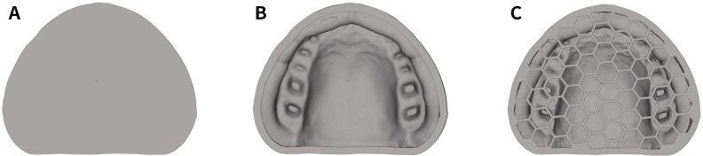 Effect of internal structures on the accuracy of 3D printed full-arch dentition preparation models in different printing systems.