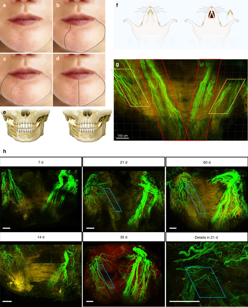 Promotion effect of TGF-β-Zfp423-ApoD pathway on lip sensory recovery after nerve sacrifice caused by nerve collateral compensation.