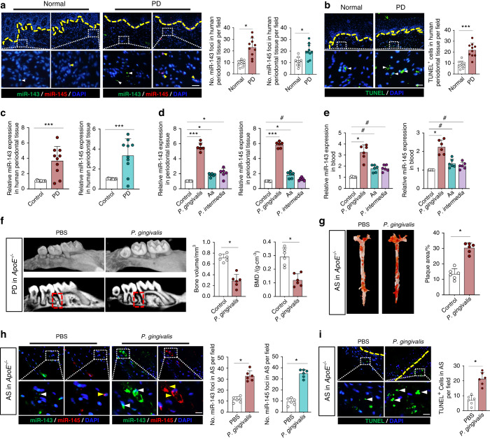 Oral pathogen aggravates atherosclerosis by inducing smooth muscle cell apoptosis and repressing macrophage efferocytosis.