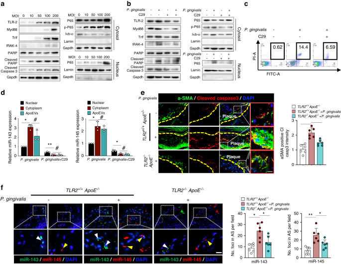 Oral pathogen aggravates atherosclerosis by inducing smooth muscle cell apoptosis and repressing macrophage efferocytosis.