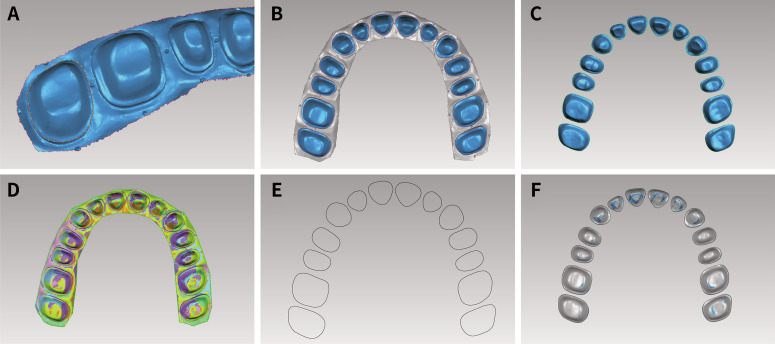 Effect of internal structures on the accuracy of 3D printed full-arch dentition preparation models in different printing systems.