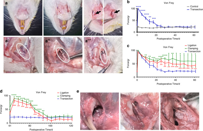 Promotion effect of TGF-β-Zfp423-ApoD pathway on lip sensory recovery after nerve sacrifice caused by nerve collateral compensation.