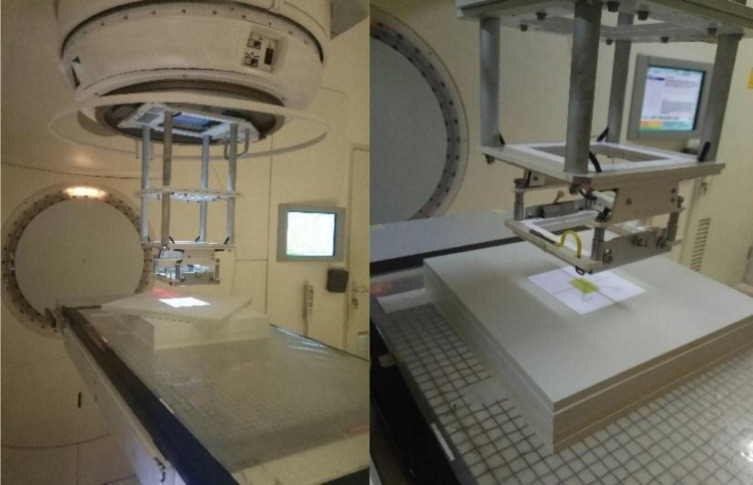 Dosimetry Evaluation of Treatment Planning Systems in Patient-Specific 3D Printed Anthropomorphic Phantom for Breast Cancer after Mastectomy using a Single-Beam 3D-CRT Technique for Megavoltage Electron Radiation Therapy.