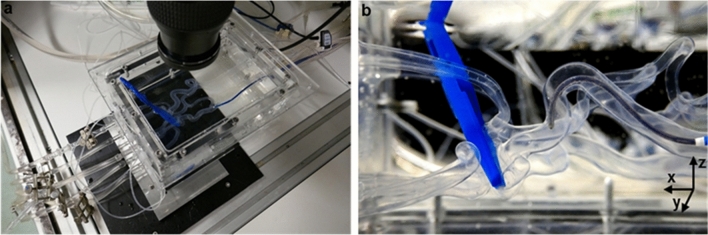 Investigation of Cerebral Hemodynamics During Endovascular Aspiration: Development of an Experimental and Numerical Setup.