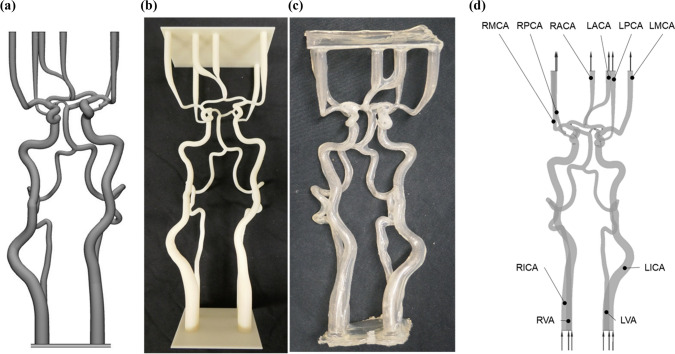 Investigation of Cerebral Hemodynamics During Endovascular Aspiration: Development of an Experimental and Numerical Setup.