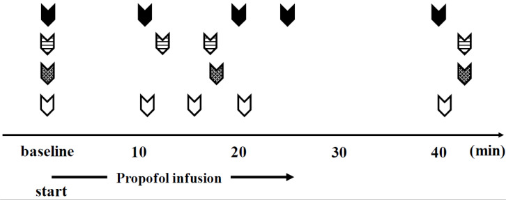 Effect of propofol on salivary secretion from the submandibular, sublingual, and labial glands during intravenous sedation.