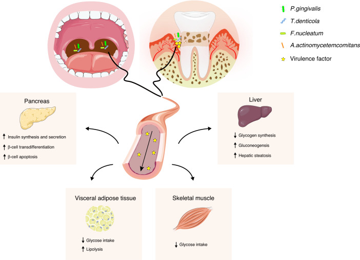 Periodontitis as a promoting factor of T2D: current evidence and mechanisms.