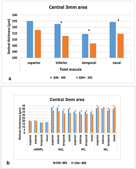 Regional Analysis of Inner Retinal Layer Changes in Multiple Sclerosis with and without Optic Neuritis.