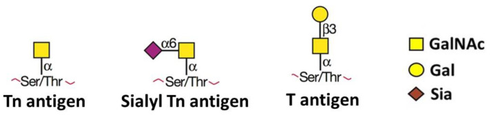 Bittersweet Sugars: How Unusual Glycan Structures May Connect Epithelial-to-Mesenchymal Transition and Multidrug Resistance in Cancer.