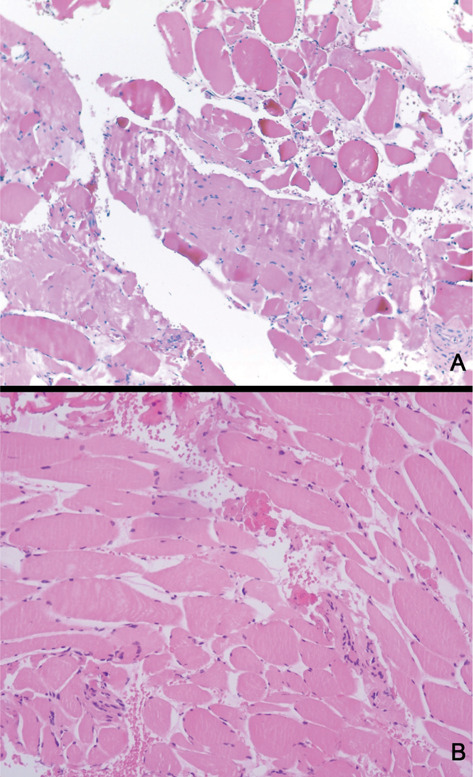 Bone turnover profile and muscular status in major orthopaedic surgery: a case series.