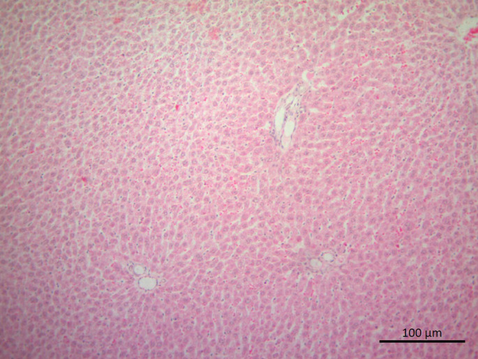 Protective Effects of Alpha Lipoic Acid Against Ionizing Radiation- Induced Hepatotoxicity in Rats.