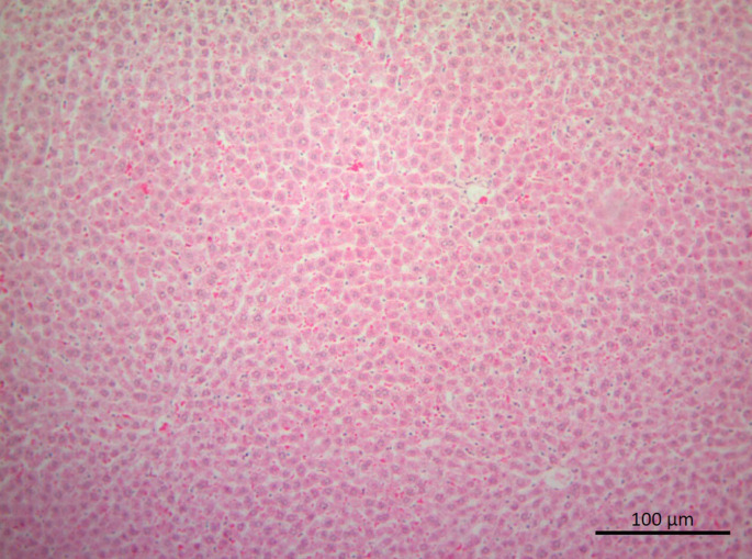 Protective Effects of Alpha Lipoic Acid Against Ionizing Radiation- Induced Hepatotoxicity in Rats.