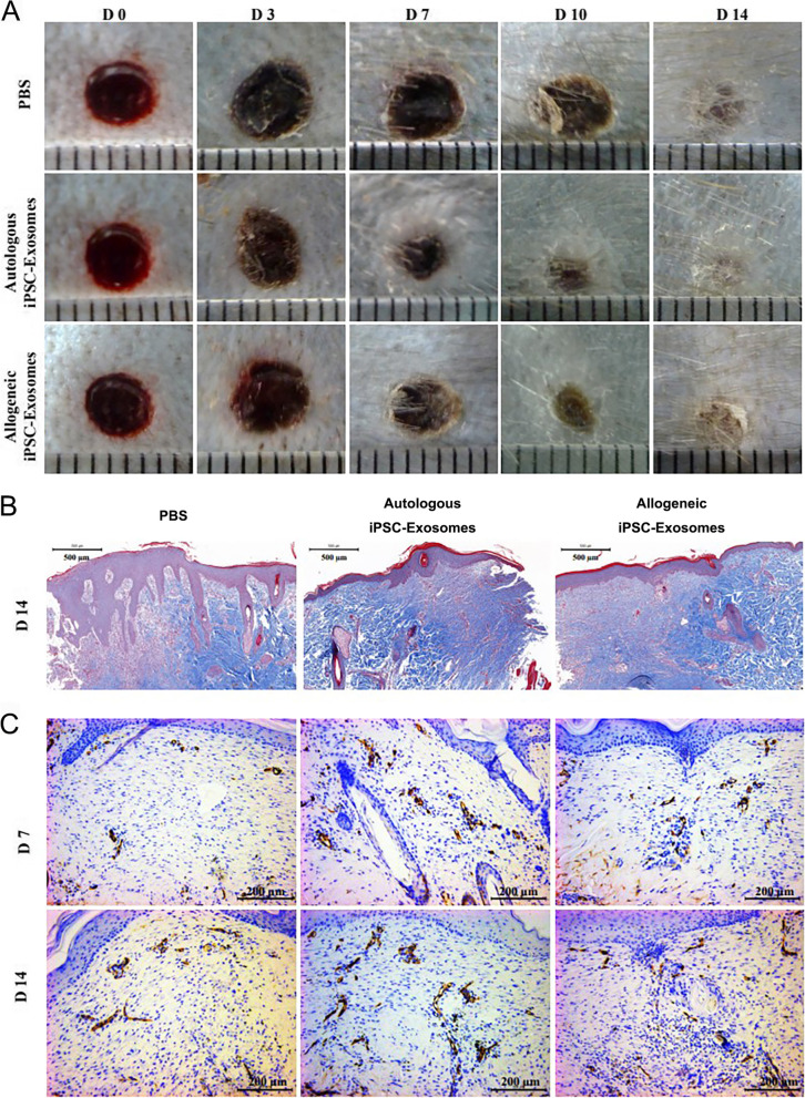 Stem cell-based drug delivery strategy for skin regeneration and wound healing: potential clinical applications.