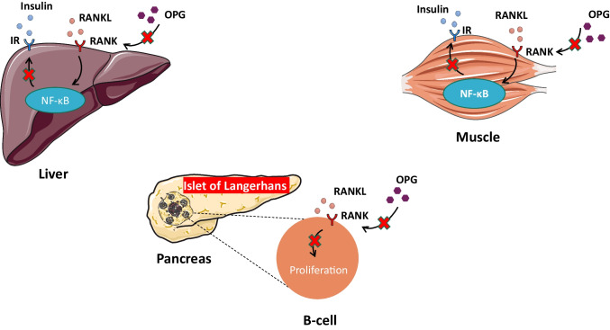 Osteoprotegerin/Receptor Activator of Nuclear Factor-Kappa B Ligand/Receptor Activator of Nuclear Factor-Kappa B Axis in Obesity, Type 2 Diabetes Mellitus, and Nonalcoholic Fatty Liver Disease.